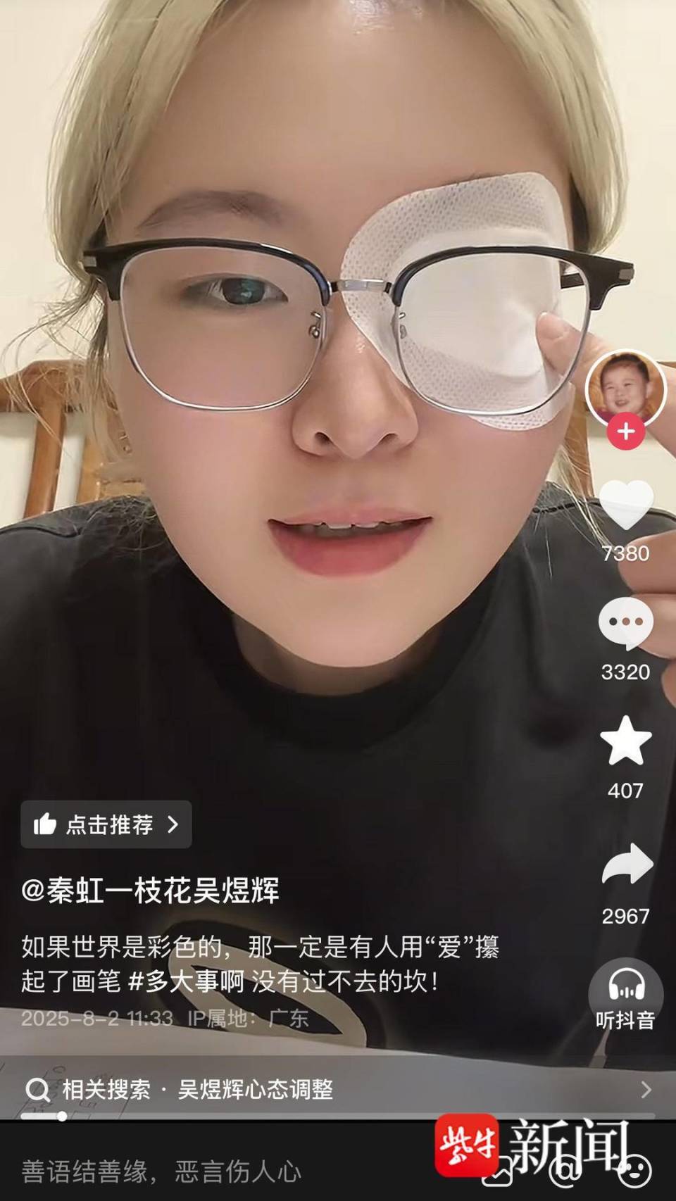 “秦虹一枝花”患多发性硬化致右眼失明，专家：俗称“美女病”，系免疫系统攻击自身神经